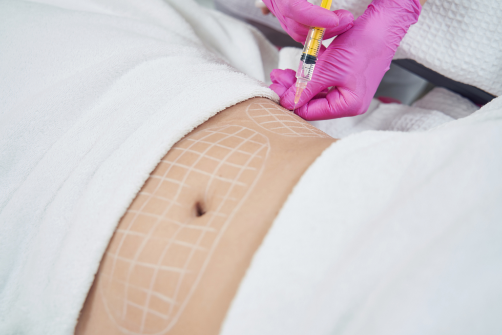 Practitioner performing a body contouring injection