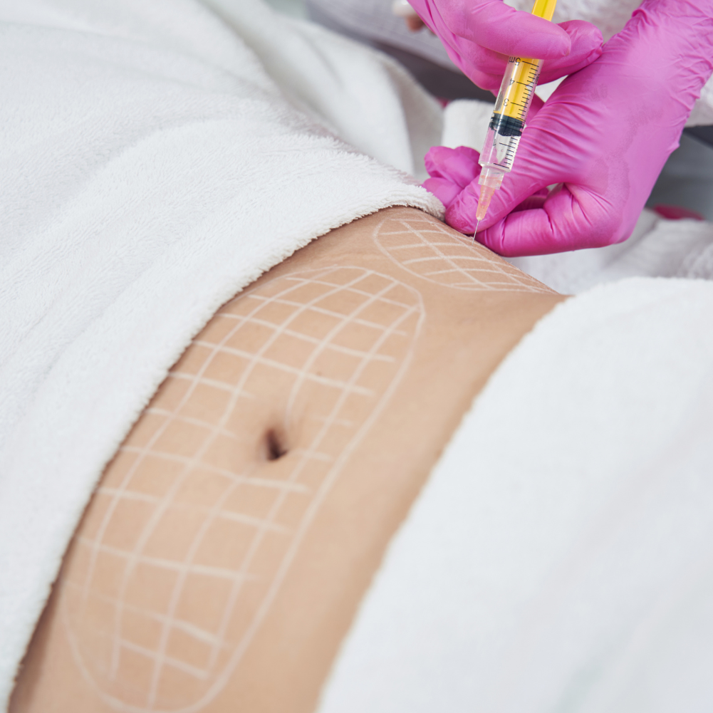 Body Contouring